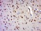 ZNF828 Polyclonal Antibody